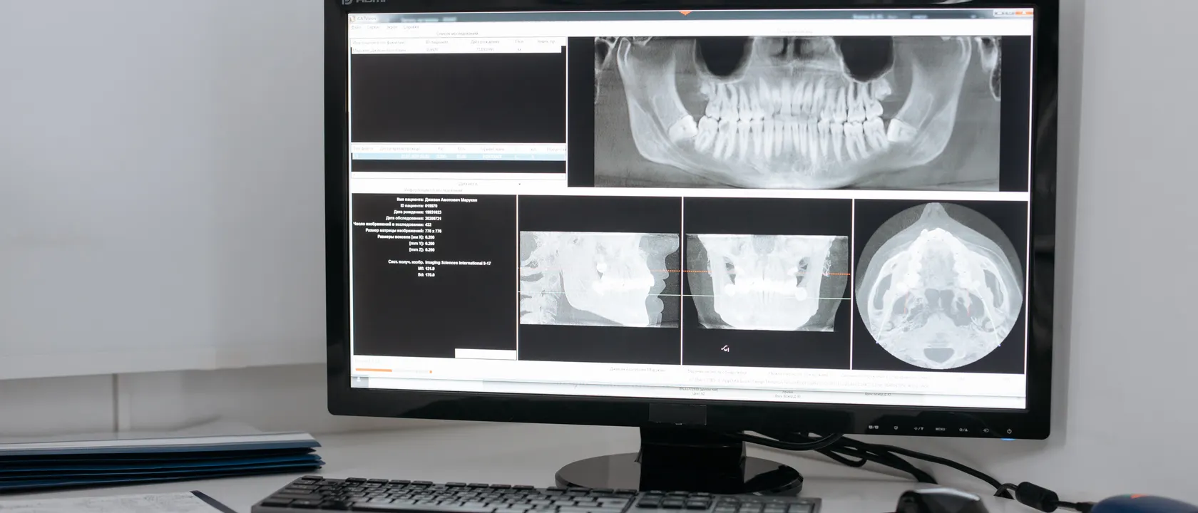A practice workstation with dental X-ray imaging software open on the monitor